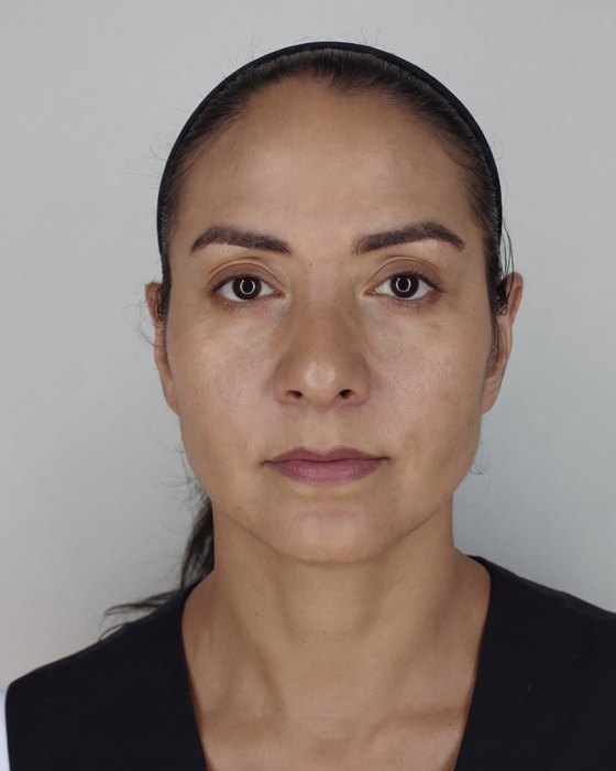 Week 12: the same woman, patches faded